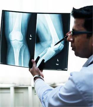 Top Arthroscopy Surgeon in Hyderabad