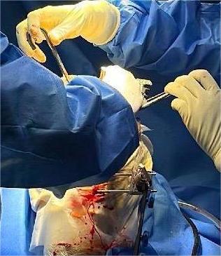 Best ACL Surgeon in Hyderabad 