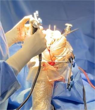 Robotic Joint Replacement Surgeon in Hyderabad
